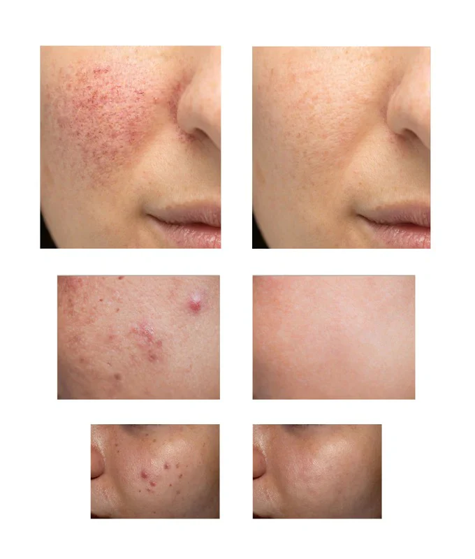 All in One Solution for skin - Image 3